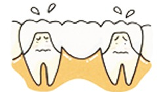 implant_image05
