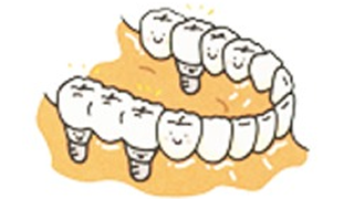 implant_image06