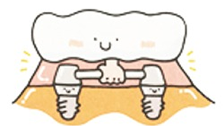 implant_image08