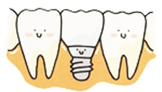 implant_image04