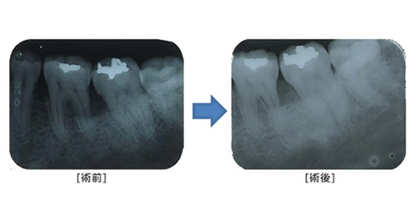periodontal_image07