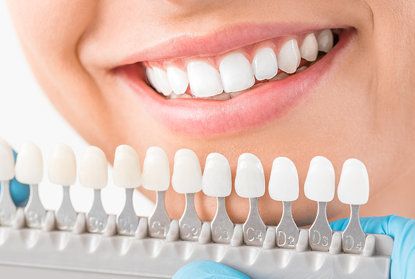 whitening_image01