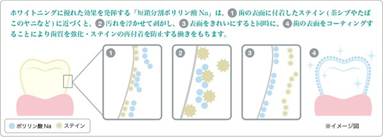 whitening_image03